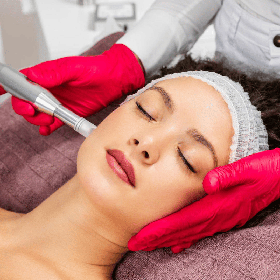 Microneedling mit PRP (Eigenbluttherapie) Für eine glattere, jugendlichere Haut